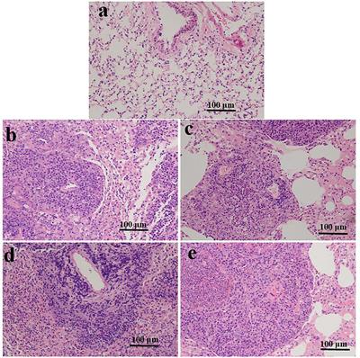 Long-Term Disturbed Expression and DNA Methylation of SCAP/SREBP Signaling in the Mouse Lung From Assisted Reproductive Technologies